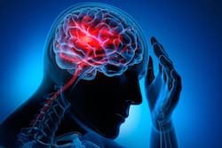 Beware! Smoking daily can put you at risk of fatal stroke