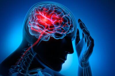 can cigarettes cause a stroke Smoking is major of Stroke: Smoking linked to higher