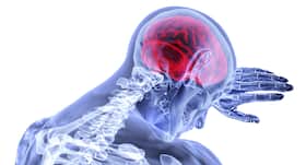 Novel gene variant may increase your risk of stroke: Study Novel gene variant may increase your risk of stroke: Study