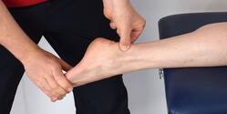 The shape of your Achilles tendon may dictate your susceptibility to injury later in life