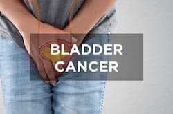 Bladder cancer: This drug can reduce death risk in patients with this condition