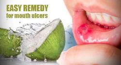 Coconut Water: An Effective Summer Home Remedy for Mouth Ulcers