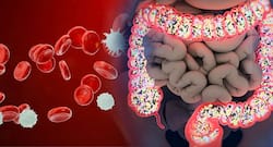 A healthy gut can improve blood cancer results, says study
