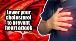 Best way to reduce your cholesterol: Combine medications with healthy lifestyle