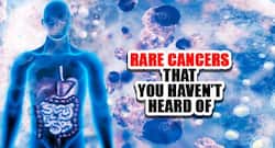 Rare types of cancer and their symptoms you should know