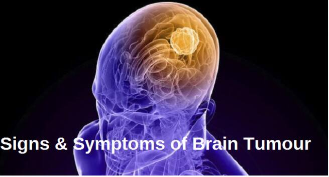 3D biopsies for better diagnosis and treatment of brain tumour