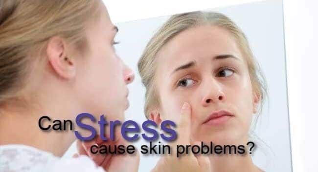 Psoriasis to eczema: Stress can severely mess with your skin