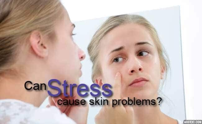 Psoriasis to eczema: Stress can severely mess with your skin ...