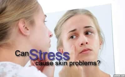 Psoriasis To Eczema: Stress Can Severely Mess With Your Skin 