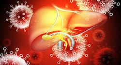 Here's how COVID-19 is affecting liver cancer patients and treatment