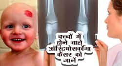 बच्चों की हड्डियों में होने वाला ऑस्टियोसर्कोमा कैंसर के कारण, लक्षण, इलाज