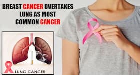 World Cancer Day 2021: Breast cancer beats lung cancer to become the most common cancer World Cancer Day 2021: Breast cancer beats lung cancer to become the most common cancer