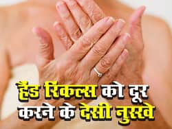 Hand Wrinkles यानी हाथों की सिकुड़ती स्किन को स्मूथ बनाएंगे ये 8 डर्मेटोलॉजिस्ट टिप्स, जानें आजमाने का तरीका