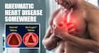 Rheumatic heart disease