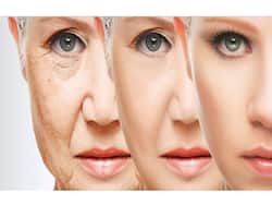 Fat loss may accelerate facial ageing: Is it irreversible?