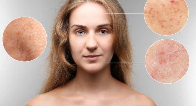 skin problem