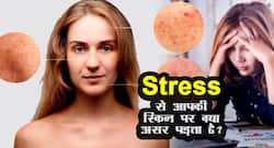 डर्मेटोलॉजिस्ट से जानिए Stress से स्किन पर क्‍या असर पड़ता है