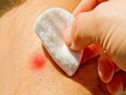 Tick-borne encephalitis: A real danger for pet-owners that can persist for years