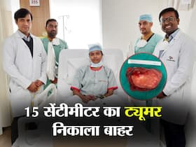 29 साल की महिला के पेट से निकाला गया 15 सेंटीमीटर का ट्यूमर, पढ़ें किस कैंसर की वजह से बना ट्यूमर