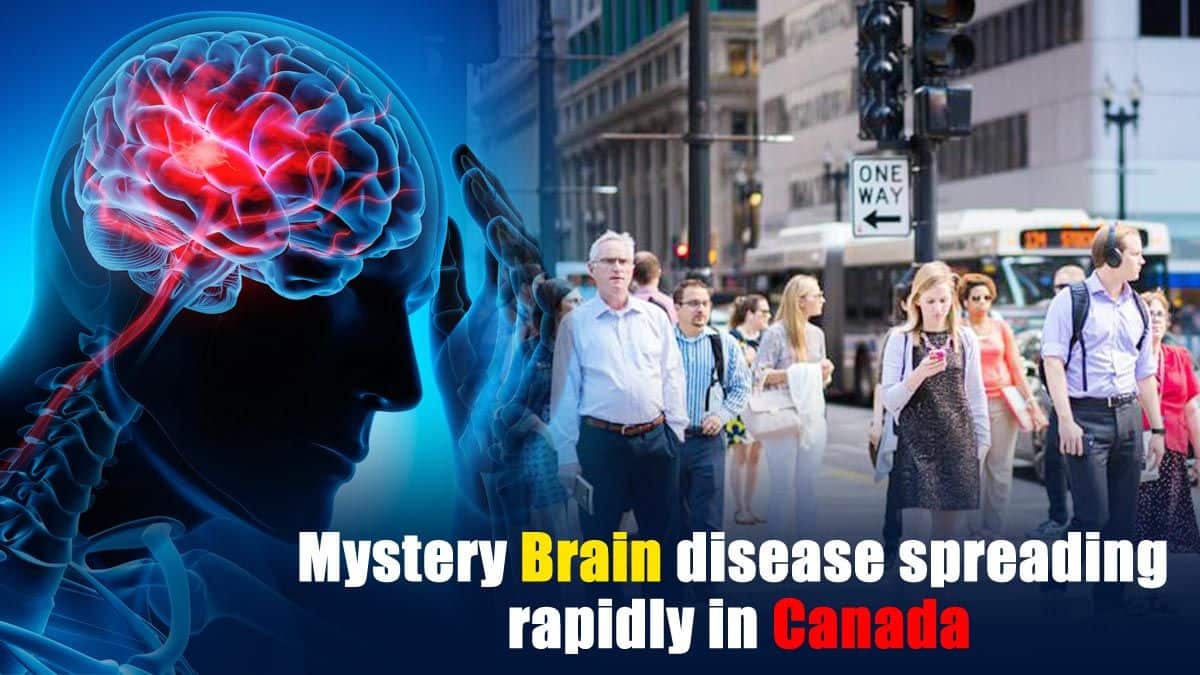 Mystery Brain disease spreading in Canada Here's what to know
