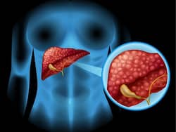What Are The Best Options Available For Liver Cancer Treatment?