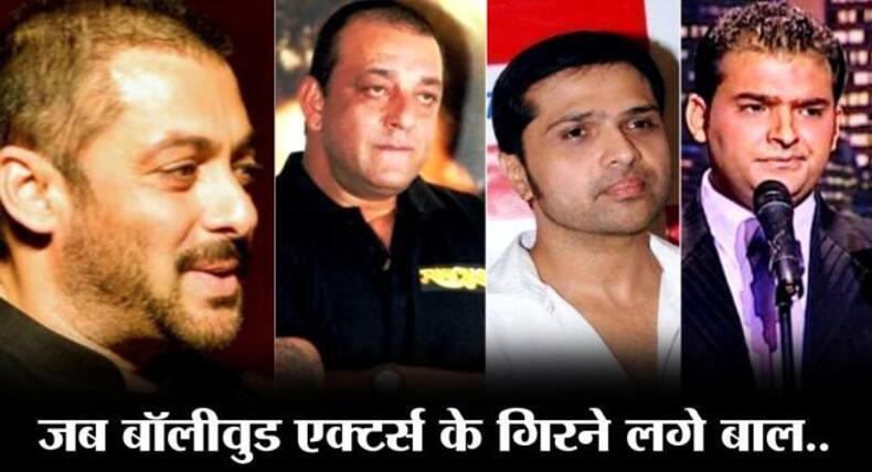 Male Baldness: कपिल शर्मा से लेकर सलमान खान तक कभी हुआ करते थे 'गंजे', जानें कैसे उगाए इन्होंने फिर से बाल
