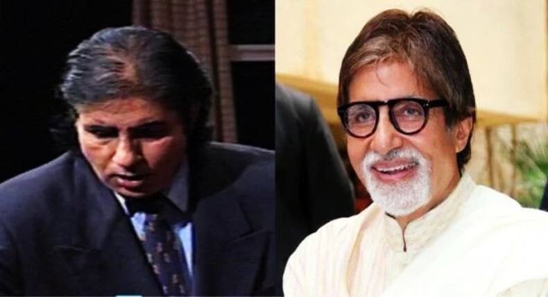 Male Baldness: कपिल शर्मा से लेकर सलमान खान तक कभी हुआ करते थे 'गंजे', जानें कैसे उगाए इन्होंने फिर से बाल