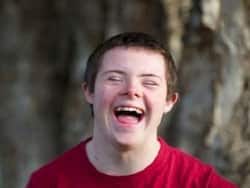 Green tea benefit: It can reduce Down's Syndrome facial dysmorphology in children