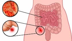 33-year-old man with a rare cancer of the appendix and small intestine, gets second lease of life