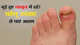 Home remedies for nails pain in hindi: अंगूठे के मुड़े नाखून में हो रहा तेज दर्द? ये 5 आसान नुस्खे दिलाएंगे फौरन राहत और चमड़ी हो जाएगी सॉफ्ट