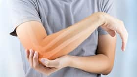 People with kidney stones more likely to suffer from osteoporosis and bone fractures: Study