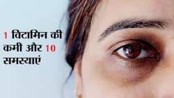 शरीर में इस विटामिन की कमी से आते हैं स्ट्रेच मार्क्स, आंखों के नीचे गड्ढे, झाइयां, डार्क सर्कल्स ! जानें और किन समस्याओं में फायदेमंद है ये विटामिन