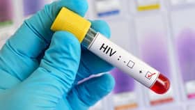 Researchers develop enzymes to block the reactivation of HIV Researchers develop enzymes to block the reactivation of HIV