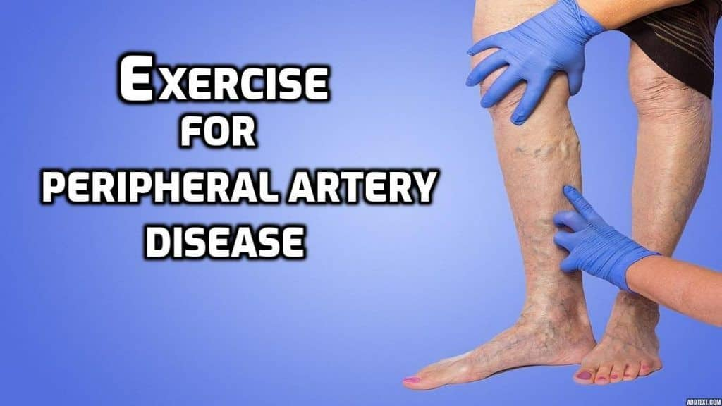 high-intensity-exercise-beneficial-for-people-with-peripheral-artery