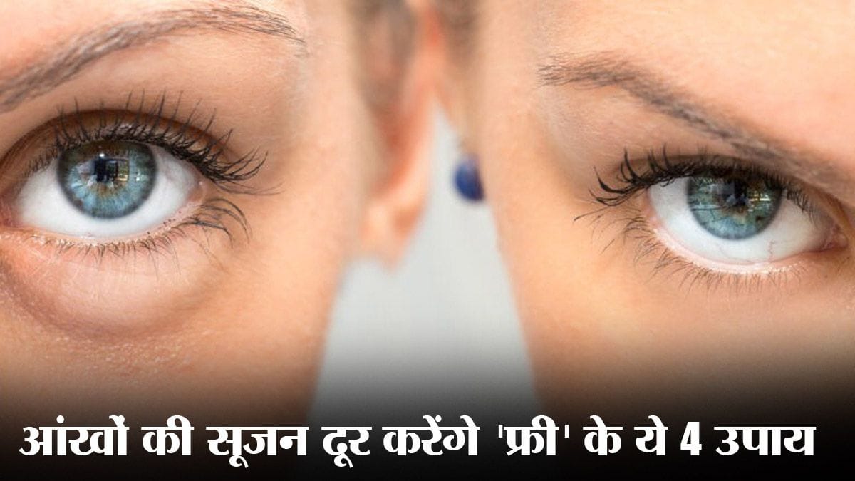 Puffy Eyes ko kaise thik kare दारू पीने या देर तक पबजी खेलने के बाद