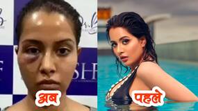Bigg Boss फेम का गलत दवाइयां खाने से बिगड़ गया चेहरा, कभी लगती थी 'अप्सरा' अब चेहरा देखना पसंद नहीं कर रहे फैंस, देखें तस्वीरें