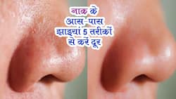 Home Remedies for Pigmentation : नाक के आस-पास जिद्दी झाइयों ने किया परेशान ? 5 देसी तरीके हफ्ते भर में देंगे पॉजिटिव रिजल्ट, ऐसे करें इस्तेमाल