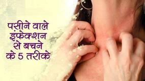 Skin infection treatment in hindi : गर्मी में पसीने से हुआ स्किन इंफेक्शन? ये 5 टिप्स कम करेंगे इंफेक्शन का खतरा, खुजली-खारिश से मिलेगी राहत