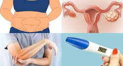 WHO: 15% Of The World's Population Experiences Subfertility