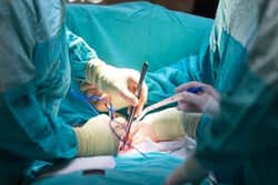 White Fungus Infects Covid Patient's Intestine, A Rare Case Seen at Delhi Hospital