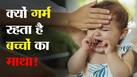 Why Baby Head is Hot: बुखार न होने के बाद भी बच्‍चों का माथा क्‍यों रहता है गर्म? डॉक्‍टर बताते हैं इसके 3 कारण