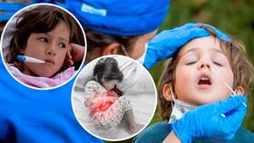 Treatment of Corona for Children: अचानक से बदल गए छोटे बच्‍चों में कोरोना के लक्षण
