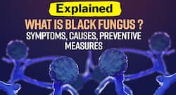 Black Fungus or Mucormycosis: Dos and don’ts, symptoms and treatment