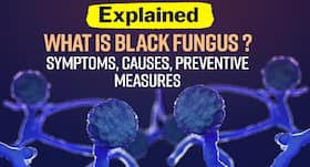 Black Fungus or Mucormycosis: Dos and don’ts, symptoms and treatment