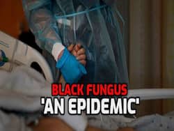 Black Fungus Declared Epidemic In Delhi Amid Surge In Mucormycosis Cases: 5 Things To Keep In Mind To Stay Safe
