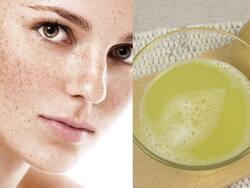 चेहरे से झाइयां और दाग-धब्‍बे हटाने के उपाय