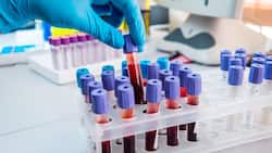 Ferritin Test क्या है और यह क्‍यों जरूरी  है