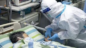 Detecting Severe COVID-19 Disease Early On: Unique Immune Response Holds The Key