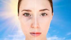 Looking For Ways To Treat Dark Spots? 6 Simple Tips To Do It