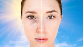 Looking For Ways To Treat Dark Spots? 6 Simple Tips To Do It